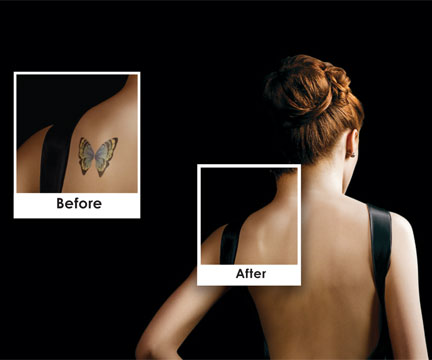 CTMAX SHOULDER TATT